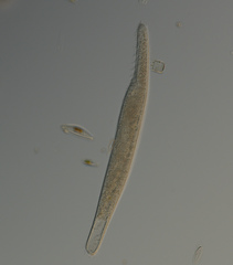 Spirostomum