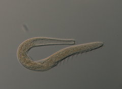 Spirostomum