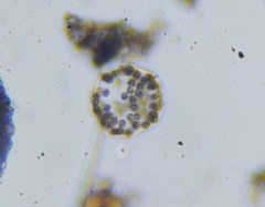 Microcystis wesenbergii