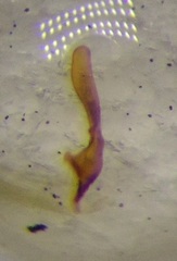 Emblethis denticollis