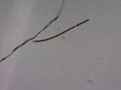 Anabaena