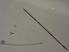 Anabaena
