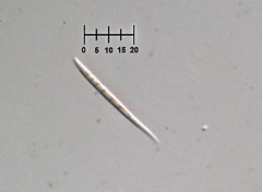 Morrisographium ulmi