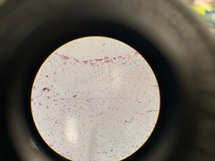Escherichia coli