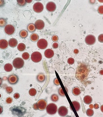 Haematococcus