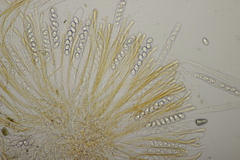 Octospora gyalectoides