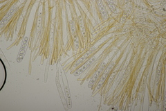 Octospora gyalectoides