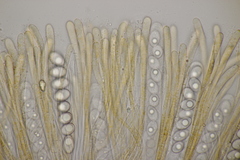 Octospora gyalectoides