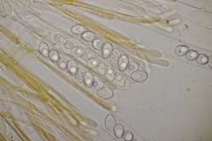 Octospora gyalectoides