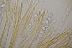 Octospora gyalectoides