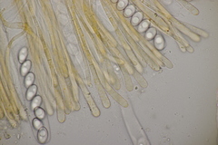 Octospora gyalectoides