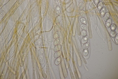 Octospora gyalectoides