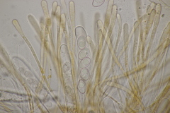 Octospora gyalectoides