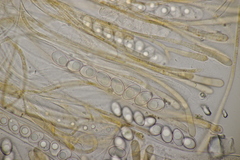 Octospora gyalectoides