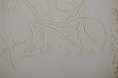 Octospora musci-muralis