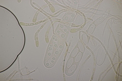 Octospora musci-muralis