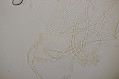 Octospora musci-muralis