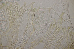 Octospora musci-muralis