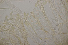 Octospora musci-muralis