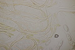 Octospora musci-muralis