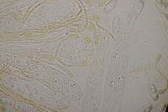 Octospora musci-muralis