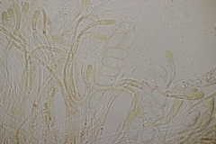 Octospora musci-muralis