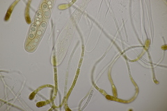 Octospora musci-muralis