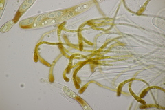 Octospora musci-muralis