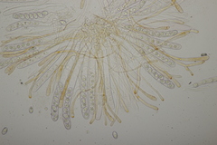 Octospora gyalectoides