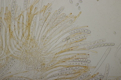 Octospora gyalectoides