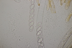 Octospora gyalectoides