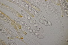 Octospora gyalectoides