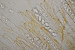 Octospora gyalectoides