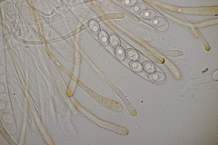 Octospora gyalectoides