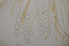 Octospora gyalectoides