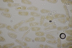 Melampsoridium hiratsukanum