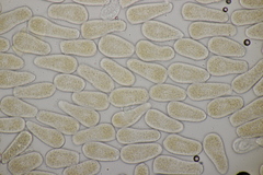 Melampsoridium hiratsukanum