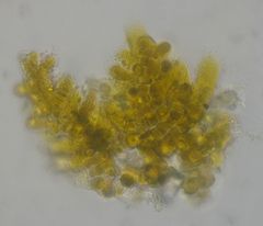 Syntrichia laevipila
