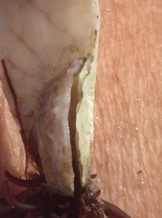 Crepipatella lingulata