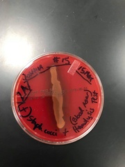 Staphylococcus aureus