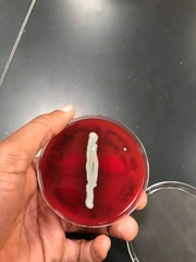 Staphylococcus aureus