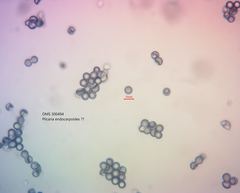 Plicaria endocarpoides