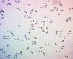 Clavariadelphus ligula