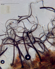 Gyrothrix podosperma