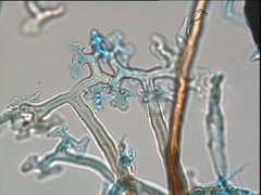 Podosphaera tridactyla