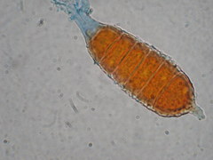 Phragmidium mucronatum