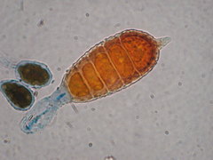 Phragmidium mucronatum