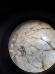 Kermesidae