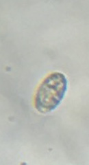 Cocconeis