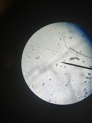 Cocconeis